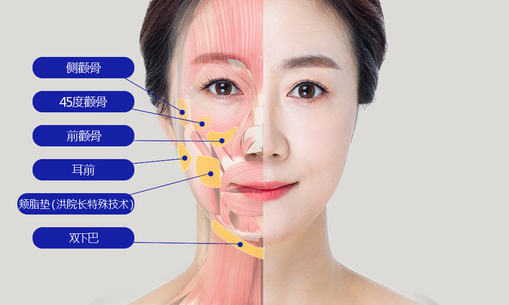 모델