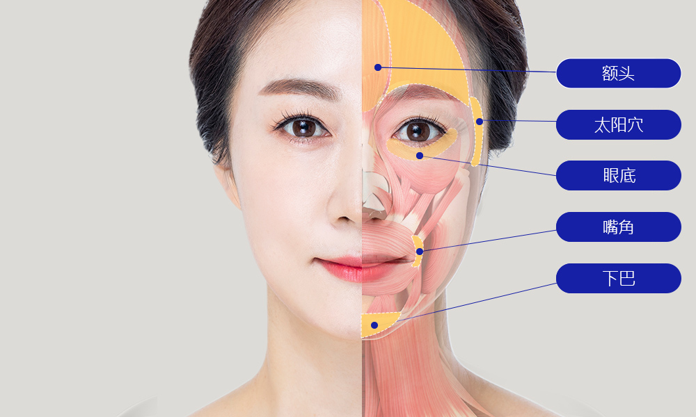 모델