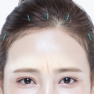 모델