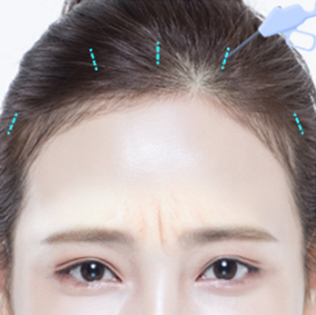모델
