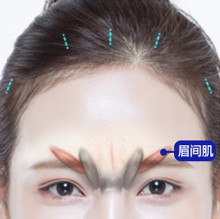 모델