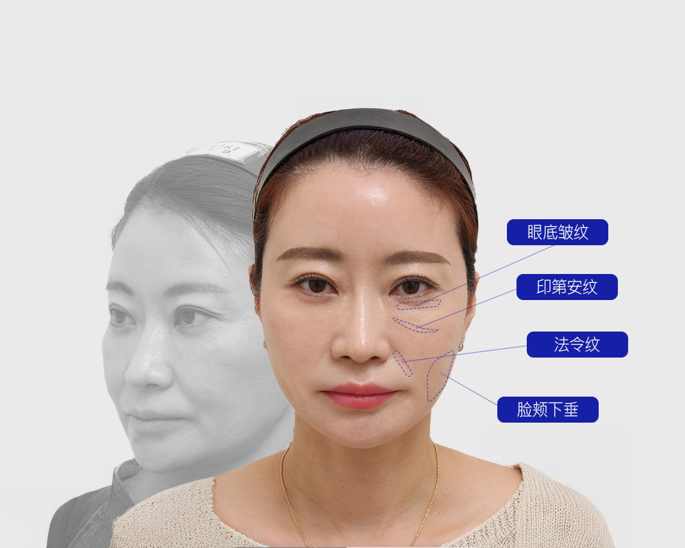 모델
