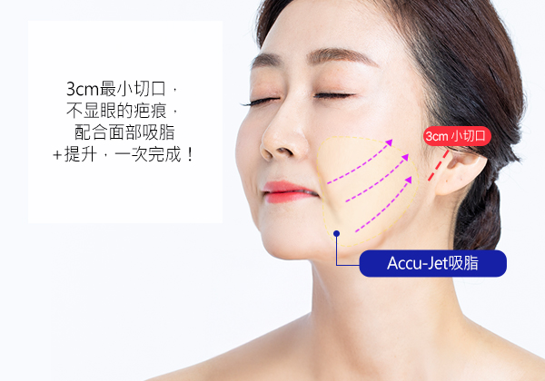 모델
