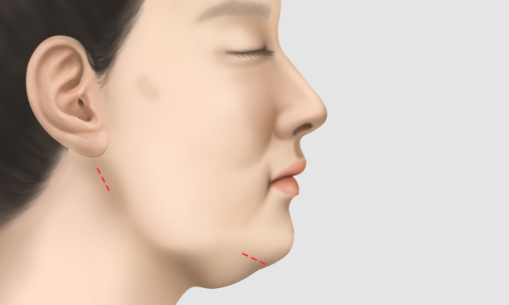 모델