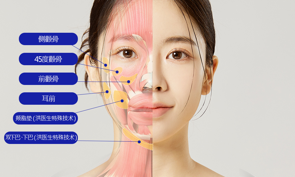 모델