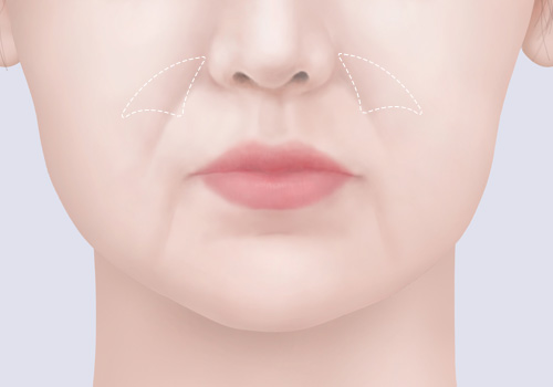 모델