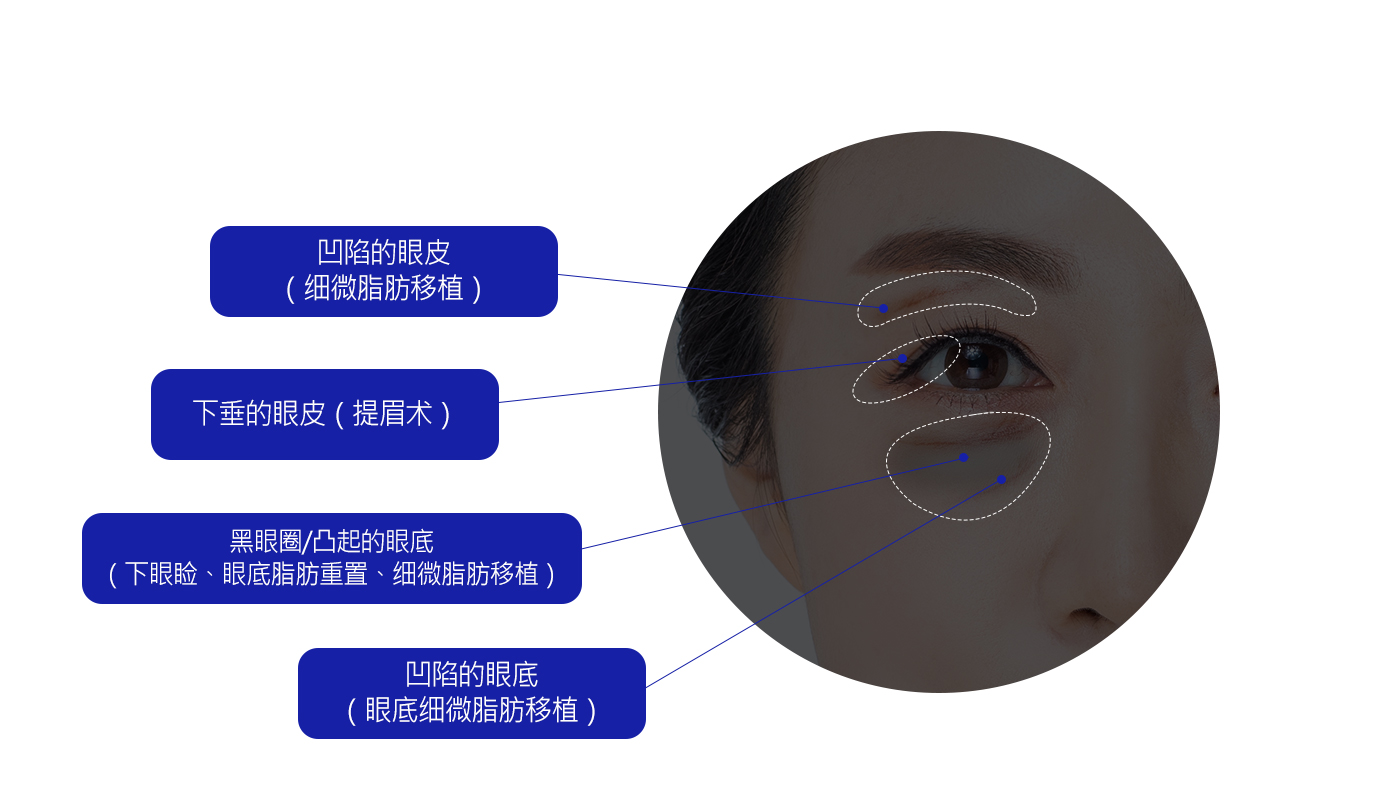 모델