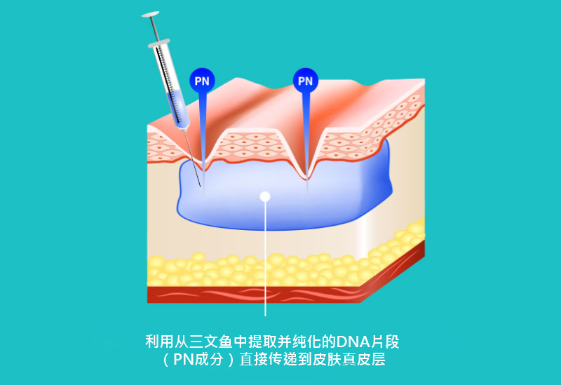 모델