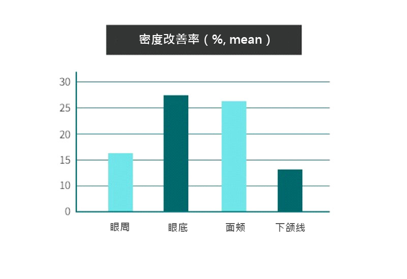 모델