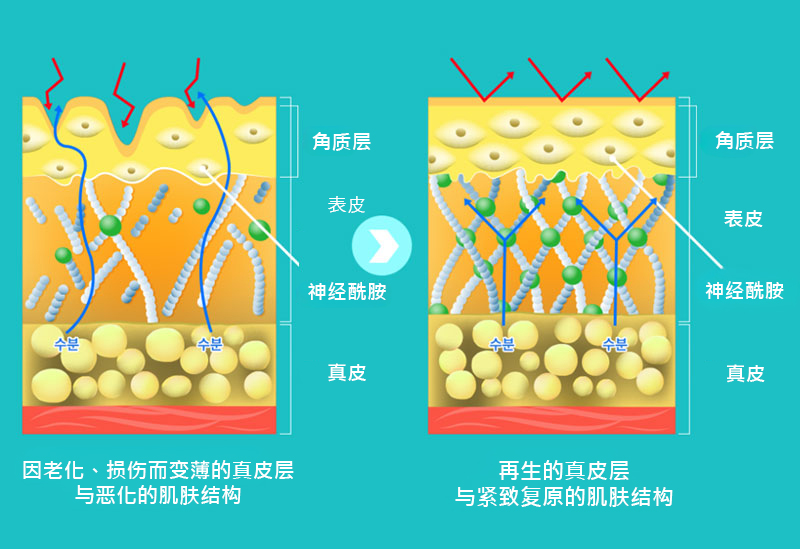 모델