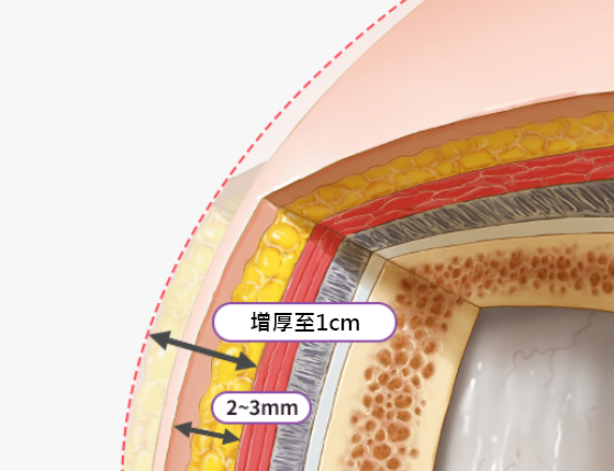 모델