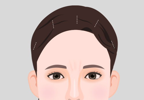 모델