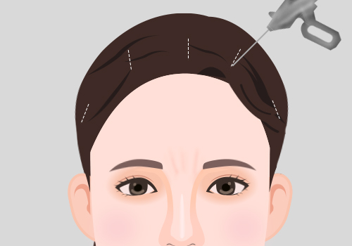 모델