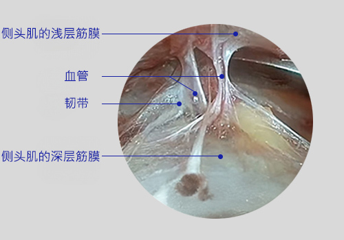 모델