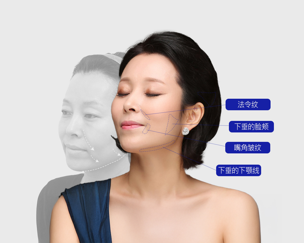 모델
