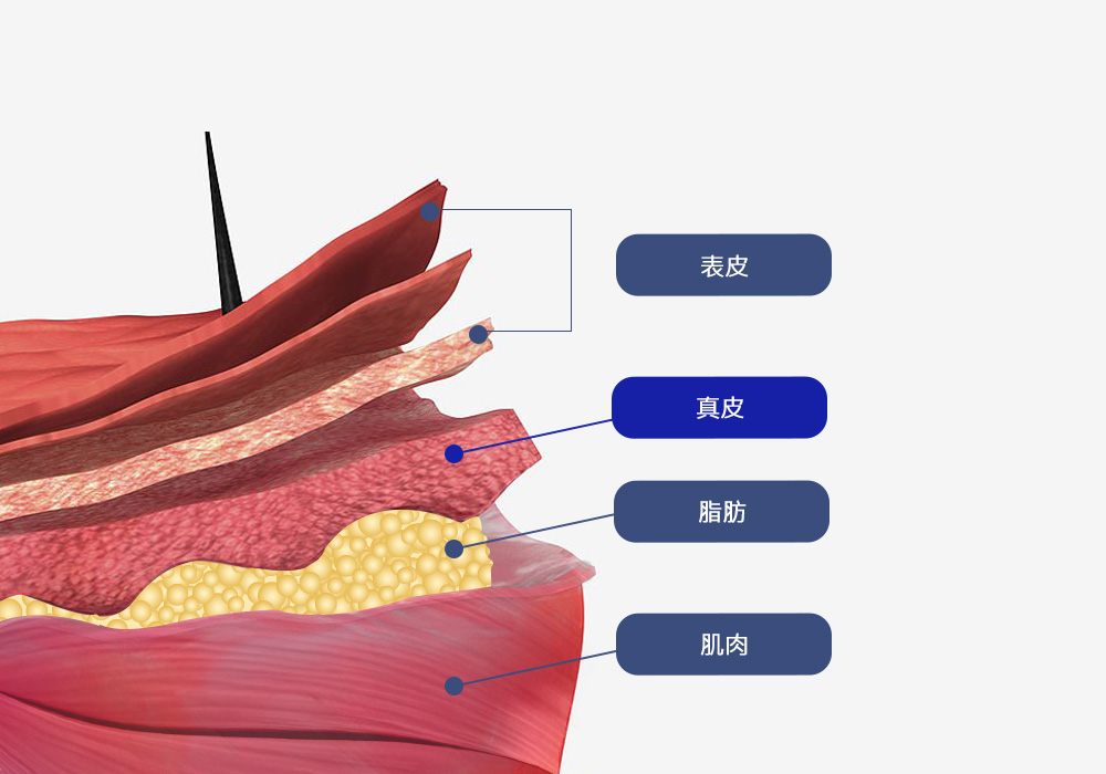 모델