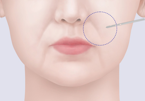 모델