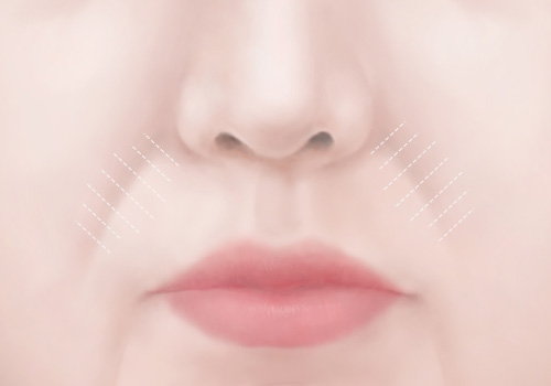 모델