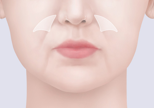 모델
